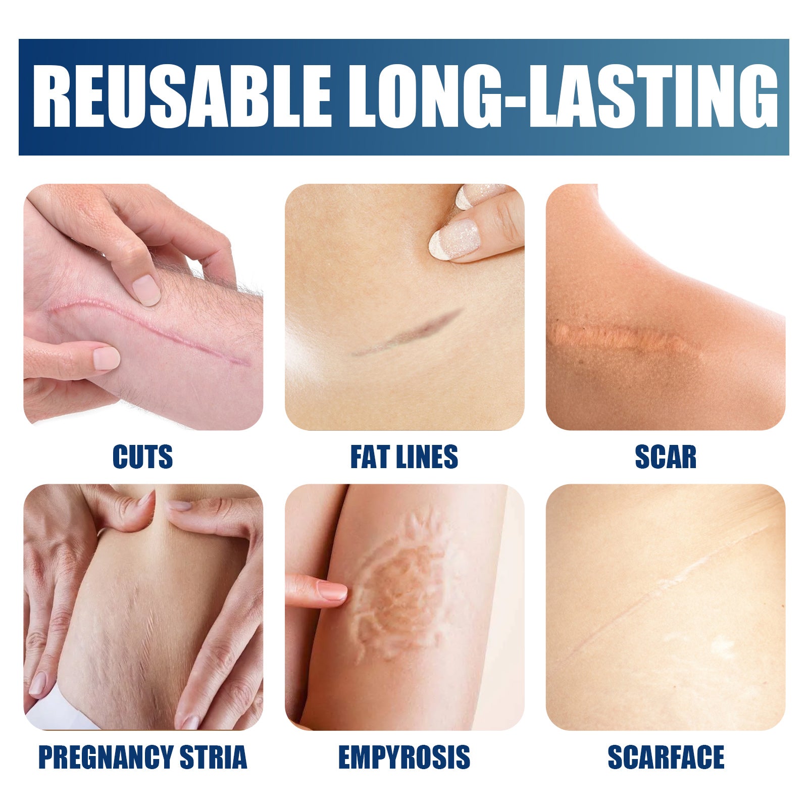 Scar Repair Gel, Repair Moisturizes Skin Smooth Scar Care Gel